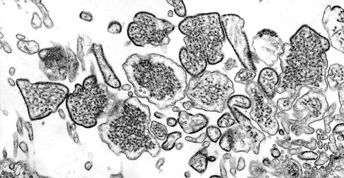Сарьсан багваахайнаас хүнд халдаж байсан ӨӨР нэг вирус