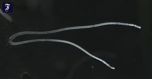 Хүний сормуус шиг хэмжээтэй хамгийн том бактери