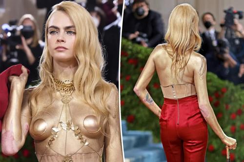 Кара Делевин ямар өвчнөөр шаналдаг вэ