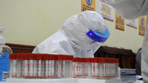 ЭМЯ: 1643 тохиолдол батлагдаж, 10 хүн нас баржээ